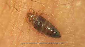 It is unusual for shark tank to do anything that shows the sharks in a bad light, but this reflects what has happened with many of robert's deals. Here S Why Bed Bugs Are So Hard To Get Rid Of Youtube