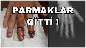 Parmaklar, birçok işlevi yerine getirir. Parmaklar Duzeliyor Mu Youtube