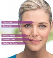 Dermal Fillers