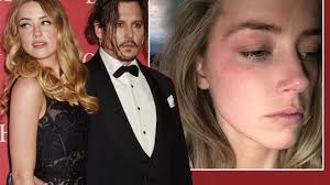 Hậu chia tay, Johnny Depp sửa hình xăm tên Amber Heard thành "đồ cặn bã"