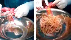 Mee segera merupakan mee separa masak yang dikeringkan dan dicampur dengan minyak, biasanya di makan setelah dimasak atau direndam dengan air panas selama beberapa minit. Siapa Suka Makan Ramen Baca Kisah Ini Untuk Peringatan Figura Malaya Informasi Malaya Terkini