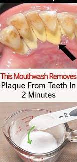 This Mouthwash Removes Plaque From Teeth In 2 Minutes Health Beauty Abc Natural Beauty Tips Beauty Tips And Tricks Health Food Health Remedies Healthy Teeth