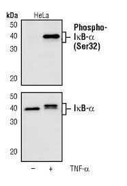 Phospho Ikb Alpha Ser32 Antibody Ma5 15087