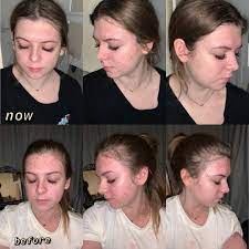 Monat Hair Skin Testimonials On Instagram Thank You Luliwien For Sharing Your Monat Skin Care Testimonial Before Monat Hair Monat Hair Skin