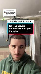 Complete Hair Growth Routine After Hair Transplant