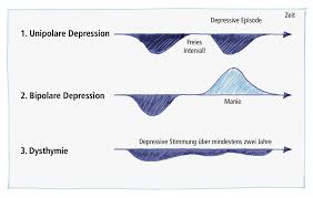 Depression is a common mental health condition that affects many australians every day. Verlaufsformen Depression Stiftung Deutsche Depressionshilfe