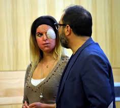 Gessica notaro, 28, whose face is badly scarred and who wears an eye patch, posted a photo of herself posing with sea lions at an aquarium in rimini this week with the message: Gessica Notaro Eta Altezza E Peso Chi E La Miss Sfregiata Con L Acido Dall Ex Fidanzato Caffeina Magazine