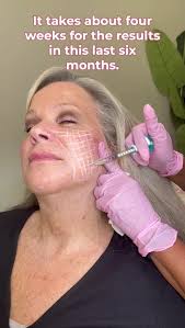 𝑻𝒊𝒎𝒆 𝒕𝒐 𝑪𝒐𝒎𝒑𝒂𝒓𝒆: 𝑺𝒌𝒊𝒏𝒗𝒊𝒗𝒆 𝒗𝒔. 𝑺𝒄𝒖𝒍𝒑𝒕𝒓𝒂 ...