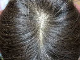 急増中 40 50代女性の薄毛問題を劇的に解決するあの方法とは lumiere 薄毛 女性 薄毛 ヘアアレンジ