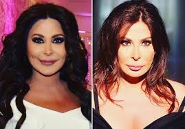 Rhinoplasty) والمعروف باسم عملية الأنف، هو إجراء جراحة تجميلية لتعديل الأنف وإعادة بنائه. ØµÙˆØ± Ø§Ù„ÙŠØ³Ø§ Ù‚Ø¨Ù„ ÙˆØ¨Ø¹Ø¯ Ù…Ø±Ø§Ø­Ù„ ØªØ·Ùˆ Ø± Ø¬Ù…Ø§Ù„Ù‡Ø§ Ø¹Ø¨Ø± Ø§Ù„Ø³Ù†ÙˆØ§Øª
