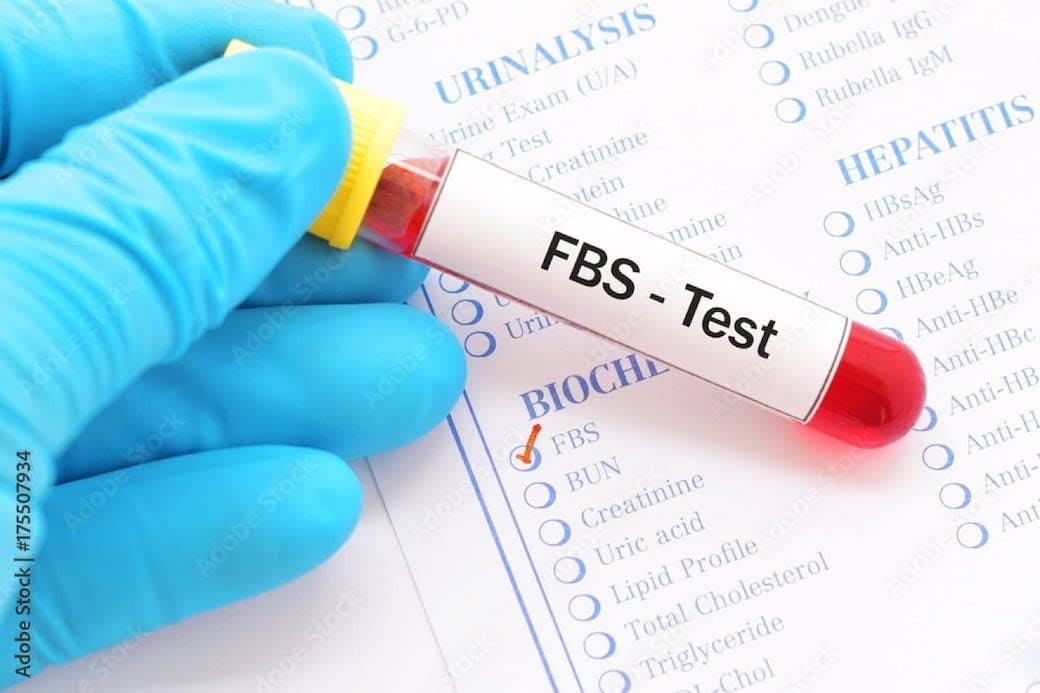 FBS product image