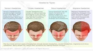 Types Of Headaches And How To Get Relief Headache Types Migraines Remedies Natural Headache Remedies