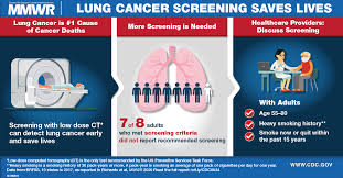 How is lung cancer treated? Screening For Lung Cancer 10 States 2017 Mmwr