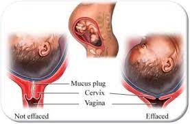Offer a vaginal examination to assess cervical dilatation and fetal head descent every 4 hours and when the woman appears to be in established labour. Vaginal Exams Don T Predict Labor The Happiest Doulas