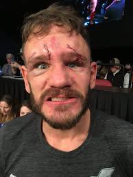 T here was a dramatic ending to a fight in the bare knuckle fighting championship, one that has gone viral online. World Bare Knuckle Fighting Federation On Twitter The Maniac Himself Themelowfelow Wbkff 1 Riseofthetitans