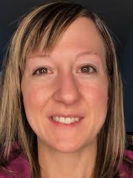 Would love some advice. I have had some under eye injections (redensity 1)  and have some swelling under my eye. It looks like they could bruise a bit.  I start a new