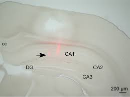 Brainstem nuclei are thus responsible for many of. State Dependent Brainstem Ensemble Dynamics And Their Interactions With Hippocampus Across Sleep States Elife