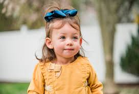 Image result for Webbed Neck