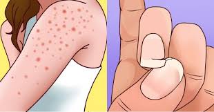 9 Signs You Re Gluten Sensitive And This Is Important To Know Signs Of Gluten Intolerance Gluten Intolerance Gluten Sensitivity Symptoms