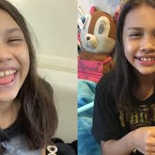 Pelakon puteri balqis yang dikatakan menghidap penyakit kanser sudah semakin sihat dan menunjukkan. Pakar Sahkan Puteri Balqis Bebas Kanser Tetapi Ada Masalah Berlainan