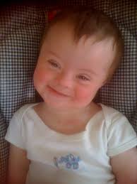 Down's syndrome support barrow- in-furness and south lakes