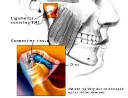 Treatment should be reserved for symptomatic patients: 10 Of The Best Approaches To Tmj Pain Treatment Pain Doctor