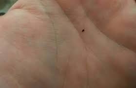 Image result for what do lice look like in dog fur