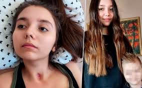 Nękana przez rówieśników Julia próbowała się zabić. Teraz zginęli jej tata  i braciszek