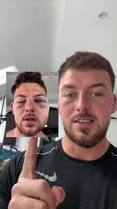 A quick update to all who are asking how i am and a massive thankyou for  all of your kind messages showing love and support #zante