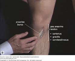 Image result for Knee Bulge Sign