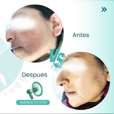 Dra. Andrea Santillán. Especialista en Dermatología