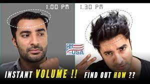 Non Surgical Hair Replacement In India Hair Patches Wigs For Men Hair Replacement Hair System Hair Replacement Systems