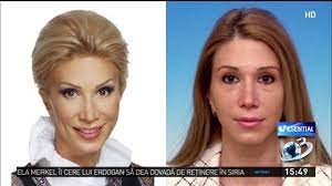 Maybe you would like to learn more about one of these? ApariÅ£ii Dezastruoase Ale Politicienilor Fotografii Inainte Si DupÄƒ OperaÅ£iile Estetice Video