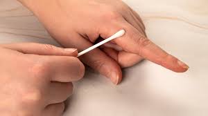 Image result for Ring Removal