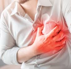 Angina pectorala este cel mai frecvent simptom cauzat de ingustarea arterelor coronare (ateroscleroza). Angina PectoralÄƒ InstabilÄƒ Cauze Simptome Tratament