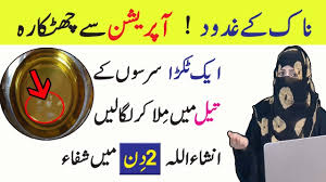 Does this really help to get rid of nasal polyps naturally, permanently and safely? Causes Symptoms Treatment Of Nasal Polyps In Urdu Anam Home Remedy Youtube