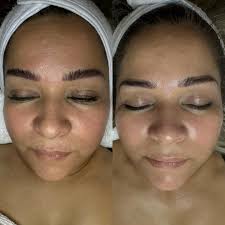 Sandra Alvarez Cosmetologa-Cosmiatra