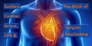 Image result for cardiac arrest