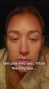 My Lasik Eye Surgery Experience: What to Expect