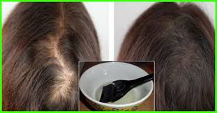Adam friedman, a program director at the. Is Castor Oil Effective For Solving Scalp Problems