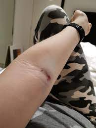 Кровь, слезы и золото (перевод alexl). Blood Test Today Yes It Hurts Mildlyinfuriating