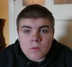 Germline mosaicism in a family with MBD5 haploinsufficiency