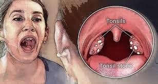 Pin On Dental Hygiene