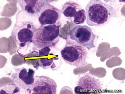 HematologyOutlines - Atlas