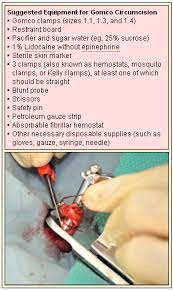 The gauze may stay in place for approximately 24 to 48 hours before falling off on its own. Newborn Circumcision The Gomco Method Consultant360