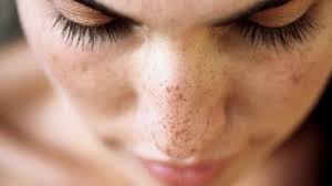 Diamkan selama 30 menit atau masker tepung beras mengering. 24 Cara Merawat Wajah Secara Alami Aman Dan Mudah Diterapkan Hot Liputan6 Com