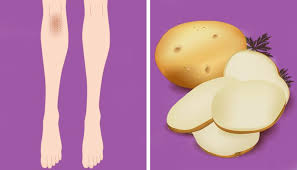 Flat rate shipping · hair accessories · styling products · gift sets 10 Natural Tricks To Remove Dark Knees And Elbows