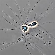 Image result for Micrargeriella