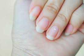 What White Spots On Nails Mean—And How To Get Rid Of Them