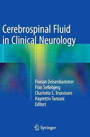 Image result for Cerebrospinal Fluid Color